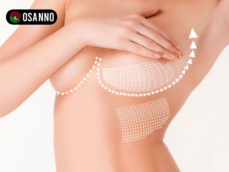 Massage ngực tác động trực tiếp lên các hạch bạch huyết