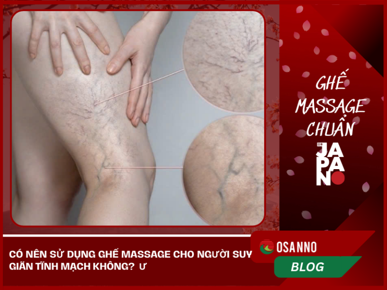 Có nên sử dụng ghế massage cho người suy giãn tĩnh mạch không?