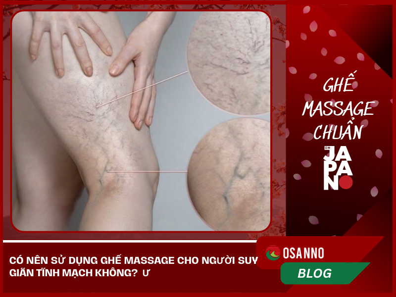 Có nên sử dụng ghế massage cho người suy giãn tĩnh mạch không?