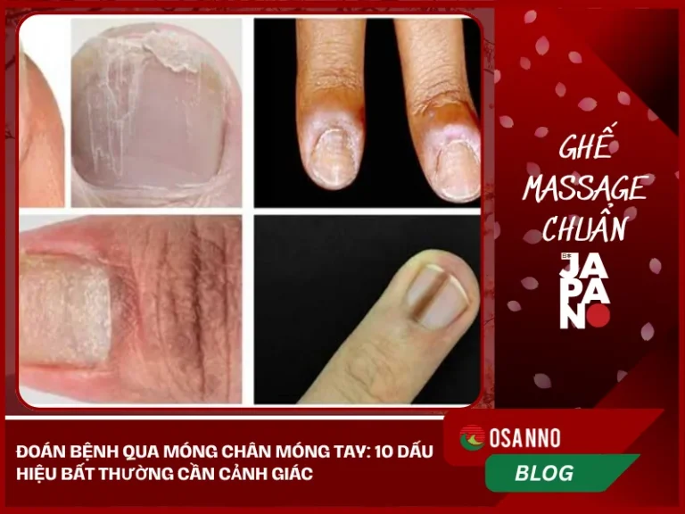 Đoán bệnh qua móng chân móng tay: 10 dấu hiệu bất thường cần cảnh giác