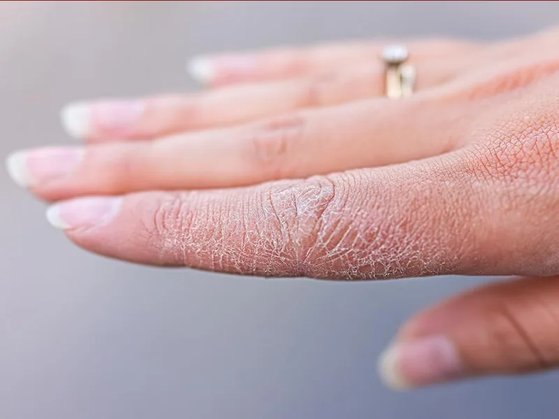 Những thói quen khiến bàn tay kém đẹp