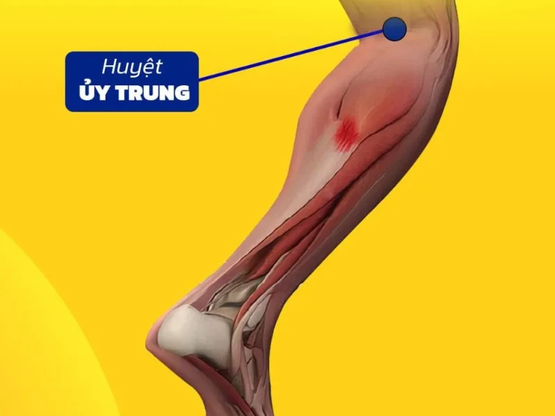 Huyệt ủy trung